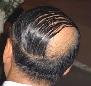 comb-over