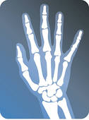 hand-x-ray