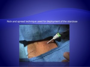 groin-management