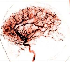 squiggly-lines-in-brain